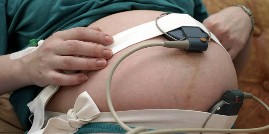 monitorizacion-fetal-ir-monitores-embarazo.jpg