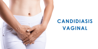Candidiasis vaginal
