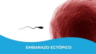 embarazo ectopico